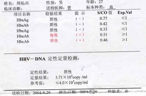 乙肝病毒dna偏高怎么办