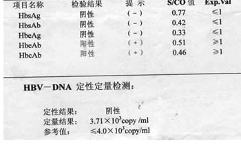 乙肝dna怎么看