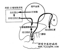 胆红素超标的原因是什么