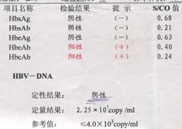 hbv dna检测结果分析