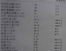 间接胆红素偏高的原因